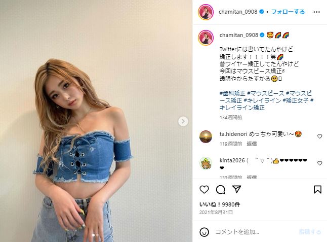 ゆうちゃみの歯列矯正に関するInstagram