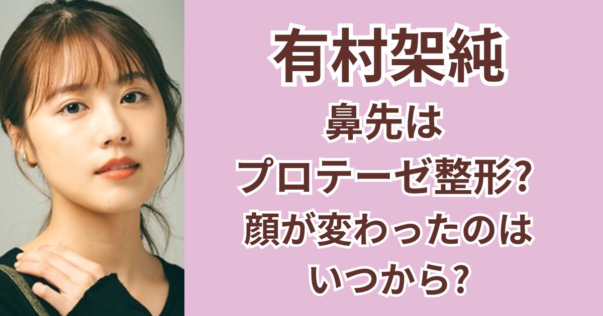 有村架純の鼻先はプロテーゼ整形？