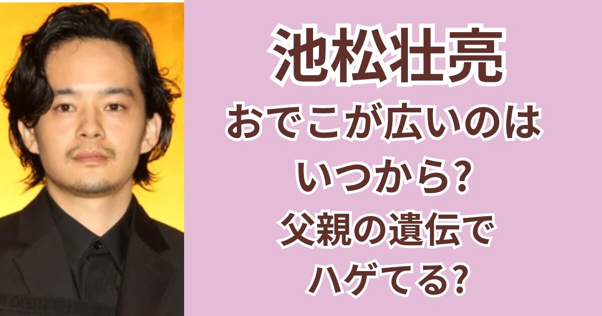 池松壮亮のおでこが広いのはいつから？