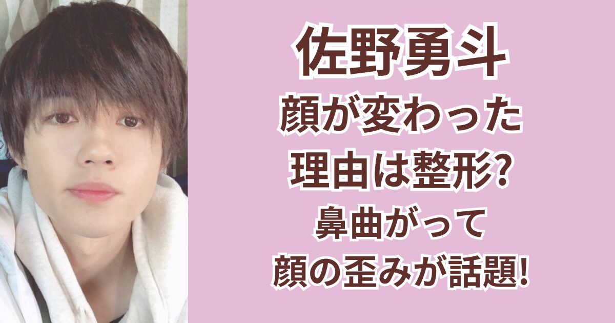 佐野勇斗の顔が変わった理由は整形？