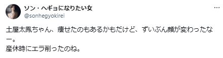 土屋太鳳が顔のエラを削ったに関するツイート